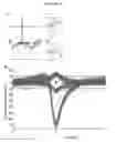Fig. 17 - Microelectorode array, methods for preparing the same and uses thereof