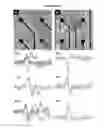 Fig. 29 - Microelectorode array, methods for preparing the same and uses thereof