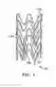 Fig. 02 - Methods to improve adhesion of polymer coatings over stents