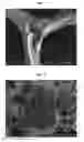Fig. 02 - DEGRADATION RESISTANT IMPLANTABLE MATERIALS AND METHODS