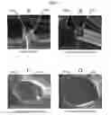 Fig. 08 - DEGRADATION RESISTANT IMPLANTABLE MATERIALS AND METHODS