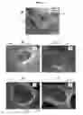 Fig. 10 - DEGRADATION RESISTANT IMPLANTABLE MATERIALS AND METHODS