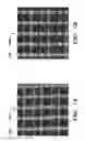 Fig. 02 - PROSTHETIC DEVICE AND METHOD OF USING IN BREAST AUGMENTATION AND/OR BREAST RECONSTRUCTION
