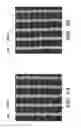 Fig. 03 - PROSTHETIC DEVICE AND METHOD OF USING IN BREAST AUGMENTATION AND/OR BREAST RECONSTRUCTION