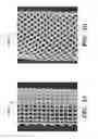 Fig. 06 - PROSTHETIC DEVICE AND METHOD OF USING IN BREAST AUGMENTATION AND/OR BREAST RECONSTRUCTION