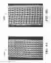 Fig. 07 - PROSTHETIC DEVICE AND METHOD OF USING IN BREAST AUGMENTATION AND/OR BREAST RECONSTRUCTION