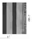 Fig. 08 - PROSTHETIC DEVICE AND METHOD OF USING IN BREAST AUGMENTATION AND/OR BREAST RECONSTRUCTION