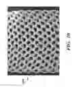 Fig. 11 - PROSTHETIC DEVICE AND METHOD OF USING IN BREAST AUGMENTATION AND/OR BREAST RECONSTRUCTION
