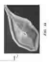 Fig. 17 - PROSTHETIC DEVICE AND METHOD OF USING IN BREAST AUGMENTATION AND/OR BREAST RECONSTRUCTION