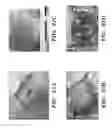 Fig. 22 - PROSTHETIC DEVICE AND METHOD OF USING IN BREAST AUGMENTATION AND/OR BREAST RECONSTRUCTION