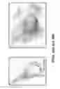 Fig. 29 - PROSTHETIC DEVICE AND METHOD OF USING IN BREAST AUGMENTATION AND/OR BREAST RECONSTRUCTION