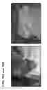 Fig. 31 - PROSTHETIC DEVICE AND METHOD OF USING IN BREAST AUGMENTATION AND/OR BREAST RECONSTRUCTION