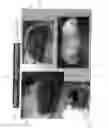 Fig. 32 - PROSTHETIC DEVICE AND METHOD OF USING IN BREAST AUGMENTATION AND/OR BREAST RECONSTRUCTION