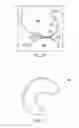 Fig. 09 - Tensioned meniscus prosthetic devices and associated methods