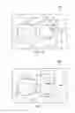 Fig. 11 - Tensioned meniscus prosthetic devices and associated methods