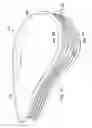 Fig. 17 - Tensioned meniscus prosthetic devices and associated methods