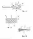 Fig. 09 - Bone support device, system and method