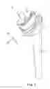 Fig. 02 - MODULAR ARTICULATING PROSTHESES AND ASSOCIATED METHODS