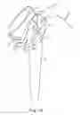 Fig. 06 - MODULAR ARTICULATING PROSTHESES AND ASSOCIATED METHODS