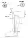 Fig. 05 - Ankle replacement system