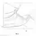 Fig. 06 - Prosthetic knee joint