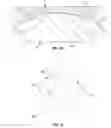 Fig. 10 - Prosthetic knee joint