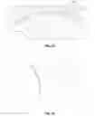 Fig. 11 - Prosthetic knee joint