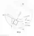 Fig. 22 - Prosthetic knee joint
