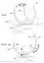 Fig. 27 - Prosthetic knee joint