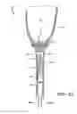 Fig. 05 - Prosthetic device utilizing electric vacuum pump
