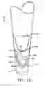 Fig. 18 - Prosthetic device utilizing electric vacuum pump