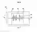 Fig. 05 - Method and system for using input signal quality in speech recognition