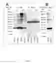 Fig. 03 - ANIMAL MODEL FOR PARKINSON'S DISEASE