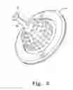 Fig. 06 - Flexible sink strainer