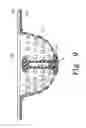 Fig. 10 - Flexible sink strainer