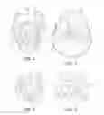 Fig. 04 - Shower Curtain Tension Rods