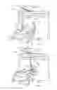 Fig. 08 - Apparatus with patient adjustment device coupled to architectural system