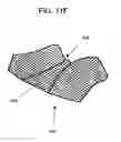 Fig. 20 - Breathable playmat