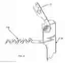 Fig. 05 - CORK REMOVAL AND WRITING IMPLEMENT DEVICE