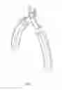 Fig. 02 - WIRE CUTTER HEAD FOR PREVENTING MISALIGNMENT OF THE CUTTING BLADES