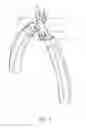 Fig. 06 - WIRE CUTTER HEAD FOR PREVENTING MISALIGNMENT OF THE CUTTING BLADES