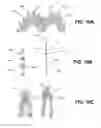 Fig. 12 - Cast removal system