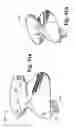 Fig. 47 - Cast removal system