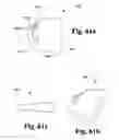Fig. 64 - Cast removal system