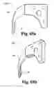 Fig. 68 - Cast removal system
