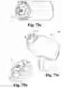 Fig. 76 - Cast removal system