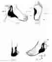 Fig. 03 - Orthotic Devices and Methods of Manufacture