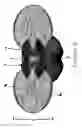 Fig. 06 - Frog Fishing Lure and Method of Use