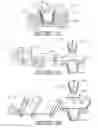 Fig. 04 - Plant package and methods of forming same using a thermoplastic flower pot