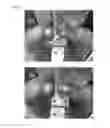 Fig. 03 - Electromagnetic forming of metallic glasses using a capacitive discharge and magnetic field